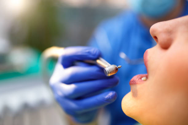 Best Teeth Whitening  in Ross, CA